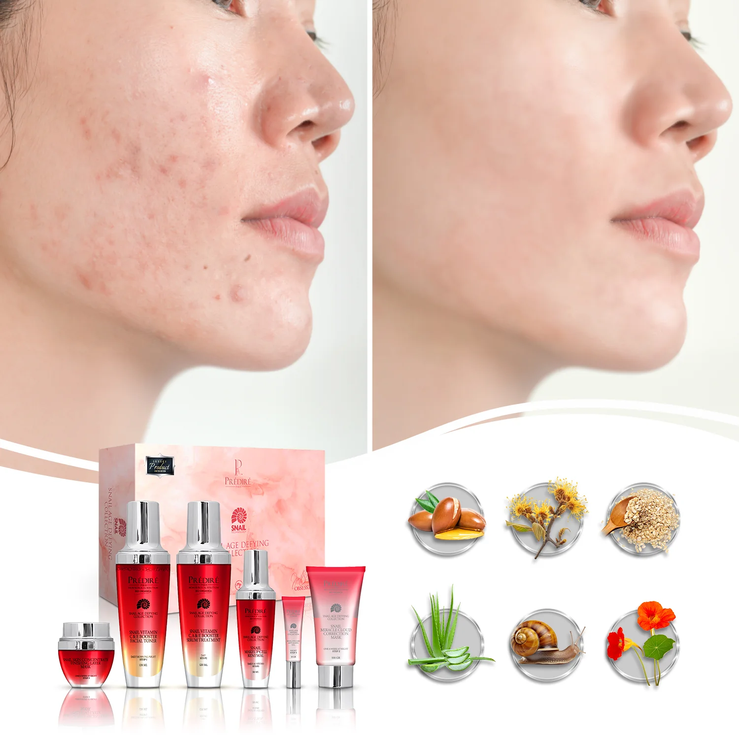 Snail Age-Defying Collection | Concentrate, Serum, Gel, Renewal, Mask, & Toner | Limited Edition - Image 4